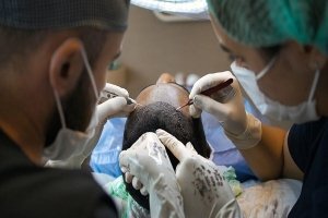 Hair Loss Treatment