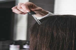 Hair Loss Treatment
