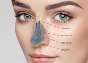 Rhinoplasty
