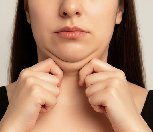Tighten the chin area without any surgery
