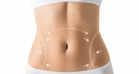 Body Contouring
